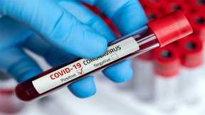 New Test Can Predict Severe COVID-19 Cases