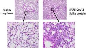 SARS-CoV-2 Spike Protein Alone May Cause COVID-19 Lung Damage – Even Without the Presence of Intact Virus