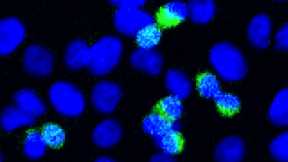 Scientists Discover a Novel Defense Mechanism Against the COVID-19 Coronavirus
