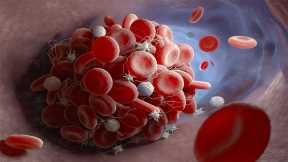 Scientists Identify Why COVID-19 Patients Develop Life-Threatening Blood Clots