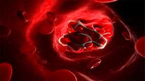 Overload of Inflammatory Molecules “Trapped” in Micro Blood Clots May Cause Long COVID Symptoms